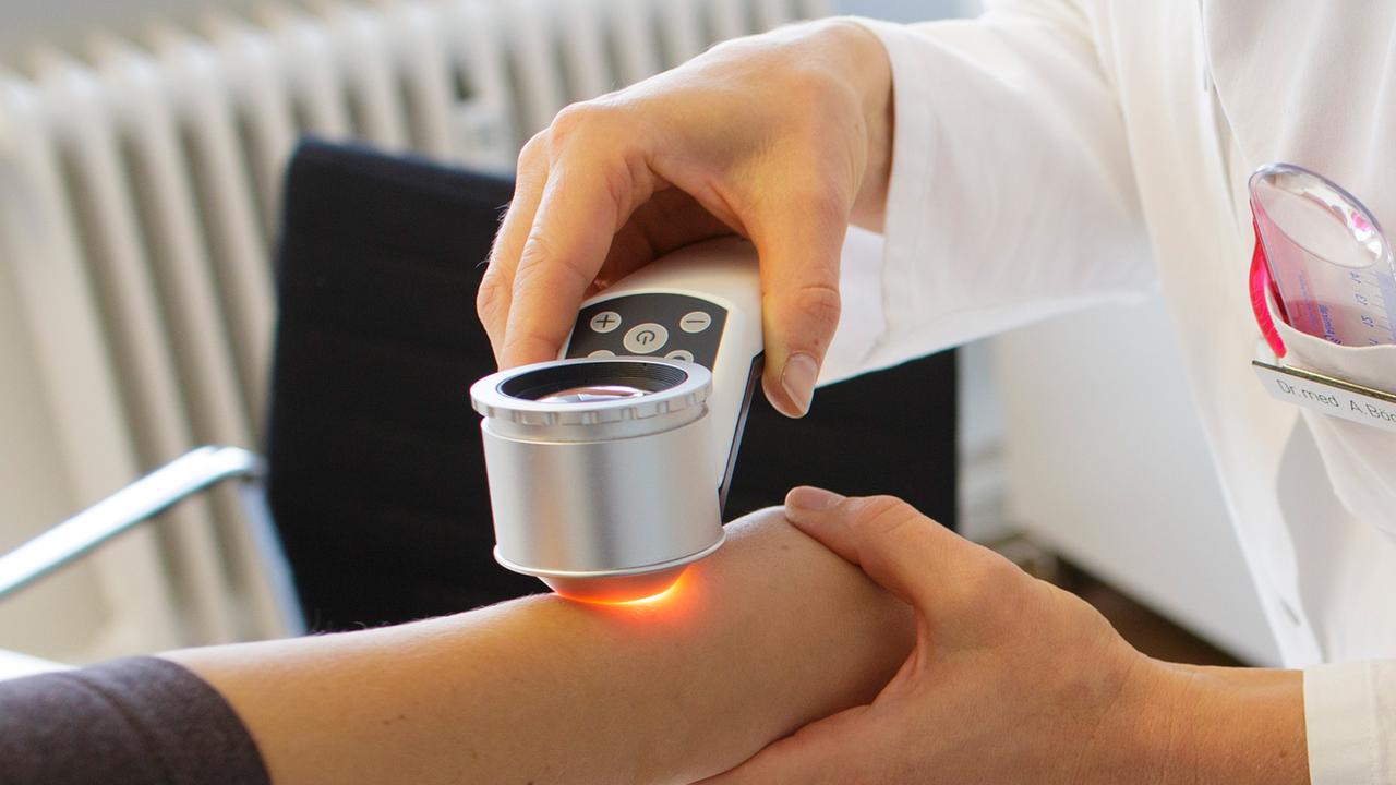 Zahl der Hautkrebsfälle in Kliniken fast verdoppelt