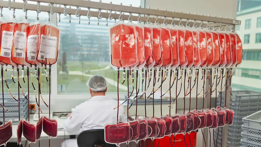Infektiosität von Amyloid Beta: Kann eine Bluttransfusion Alzheimer auslösen?