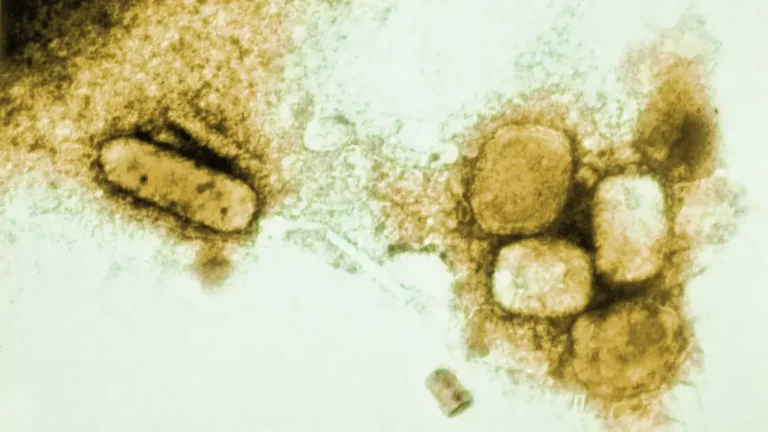 Ein Virus, Millionen Tote: Europäer brachten die Pocken nach Amerika