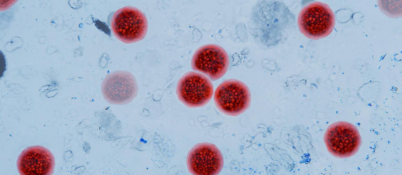 Cyclospora Parasit: Mehr als 10.000 Durchfallfälle in den USA bestätigt